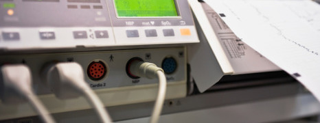 EKG